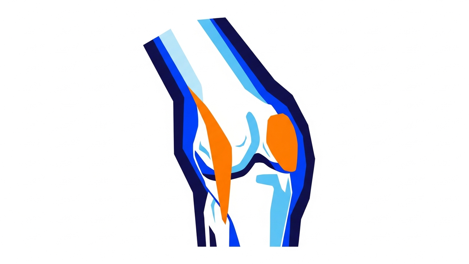 Syndrome de l'essuie-glace (TFL ou ITBS) : reconnaître et soigner